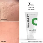 NOVOLOGY Acne Deep Clearing Cleanser (150g) (1)