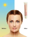 Hydroquinone 2